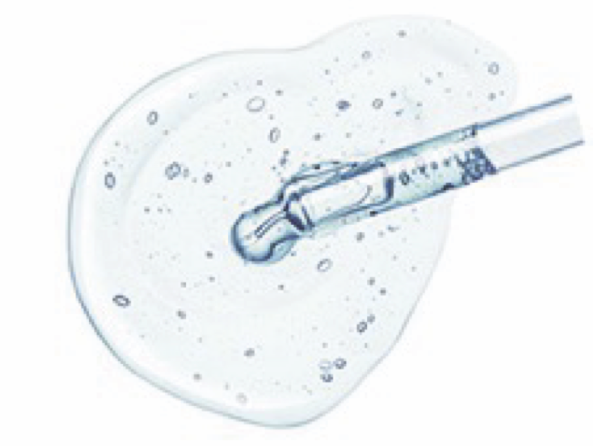 Image of dropper filled with clear gel